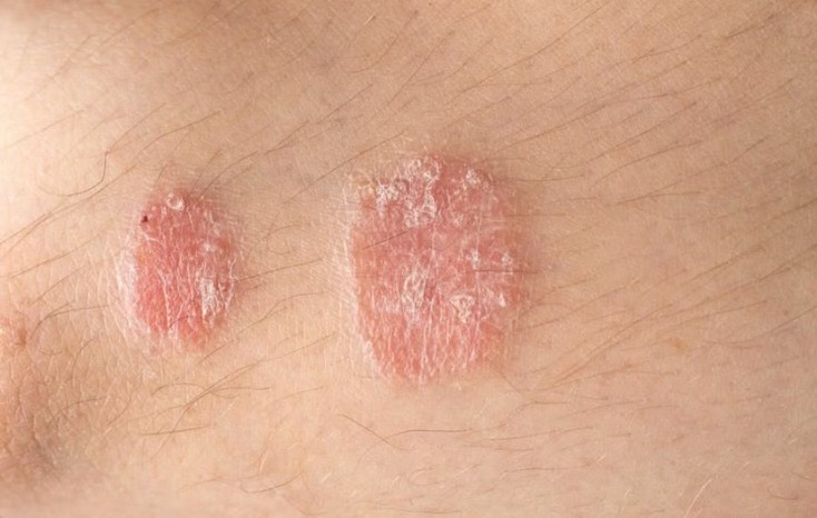 If you notice these signs on your body, consult a…