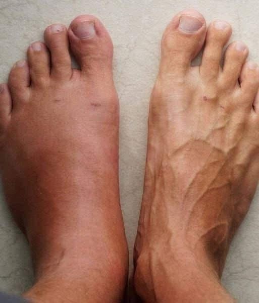 One month before a heart att.ack, your body will send you of these 6 signs.