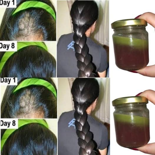 **Indian Herbal Remedies for Hair Growth**