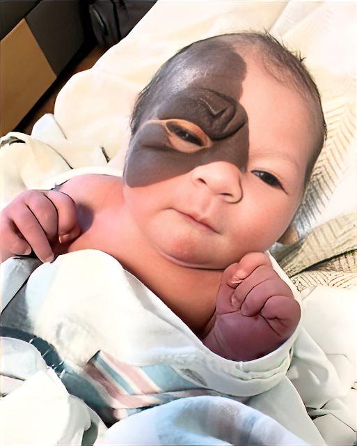 Mother’s Wish for Daughter: Embracing the Beauty of Her Rare Birthmark