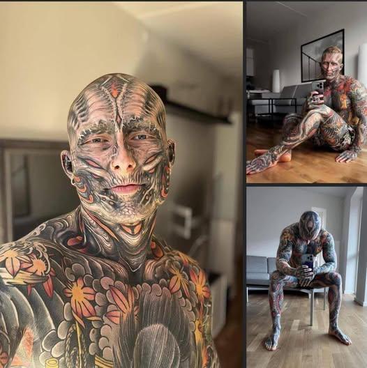 95 Percent Of His Body, Reveals What He Looked Like Just 5 Years Ago.