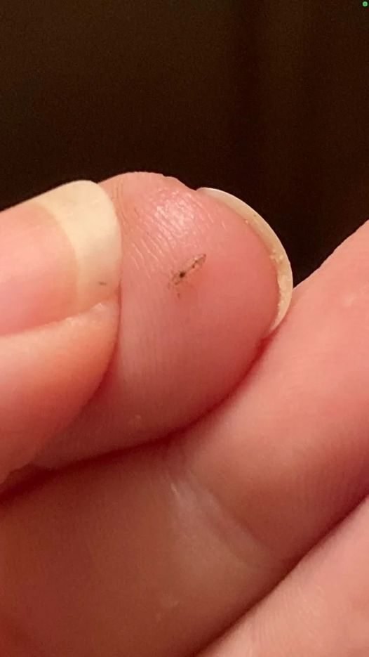 What is this? Is this lice? Only one came out of my hair