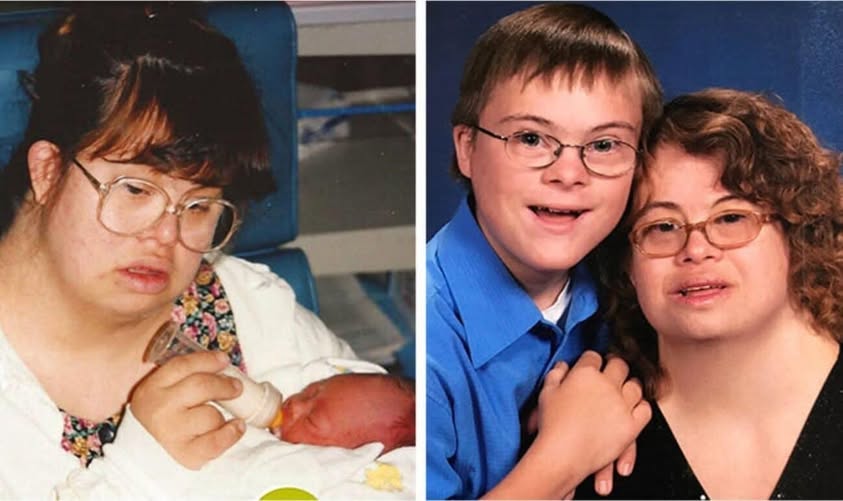 She defied all societal expectations and gave birth to a baby boy. She became a single mother, and faced challenges head-on with her son by her side. Both have Down syndrome but do not let it stop them from living life. Now her son is 27…