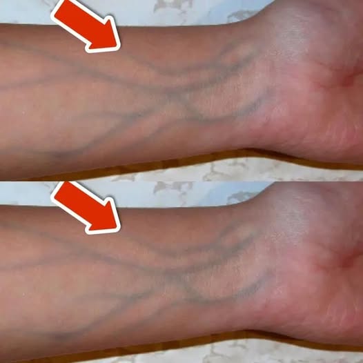 5 Signs of Poor Circulation You Should NEVER Ignore…