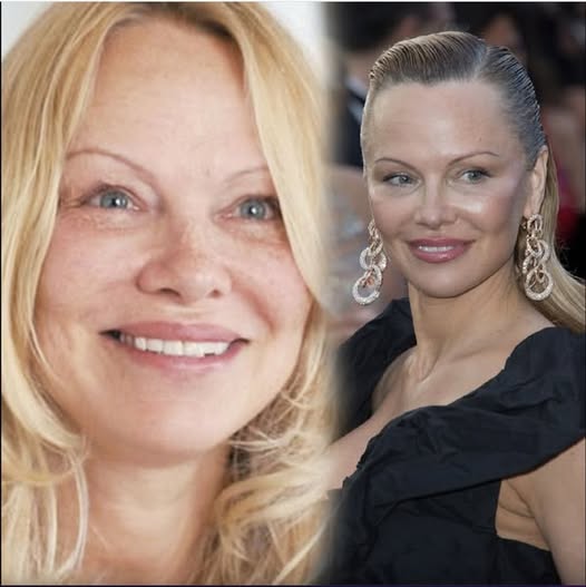 Pamela Anderson refuses to do anything “crazy” to prevent her aging and the latest photos of her confirm what we all knew… Check the comments: