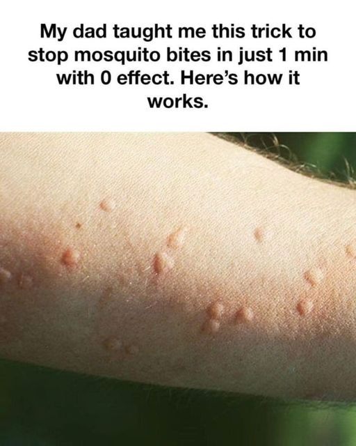 Tricks To Stop Mosquito Bites In Just 1 Minutes With 0 Effect!