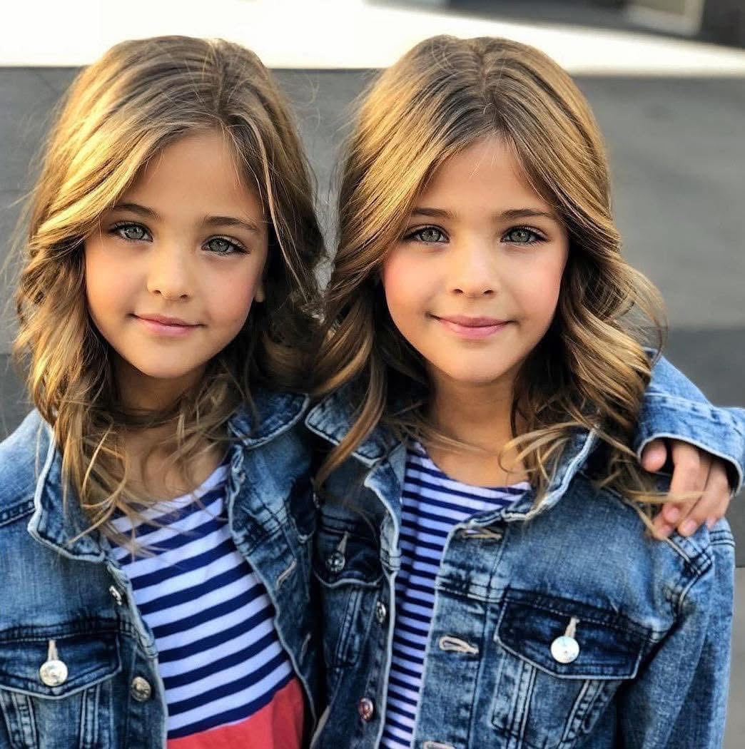 12 Years Ago, They Were Known as the World’s Most Beautiful Twins – Here’s How They’ve Changed!