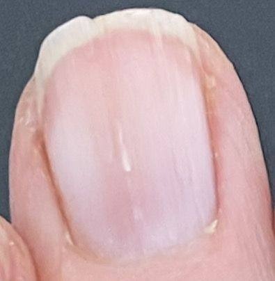 Here’s What Your Nails Say About Your Health