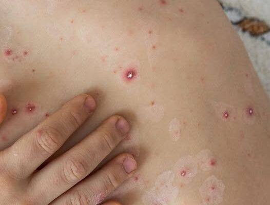 Red Dots on Your Skin: Causes and What They Could Mean