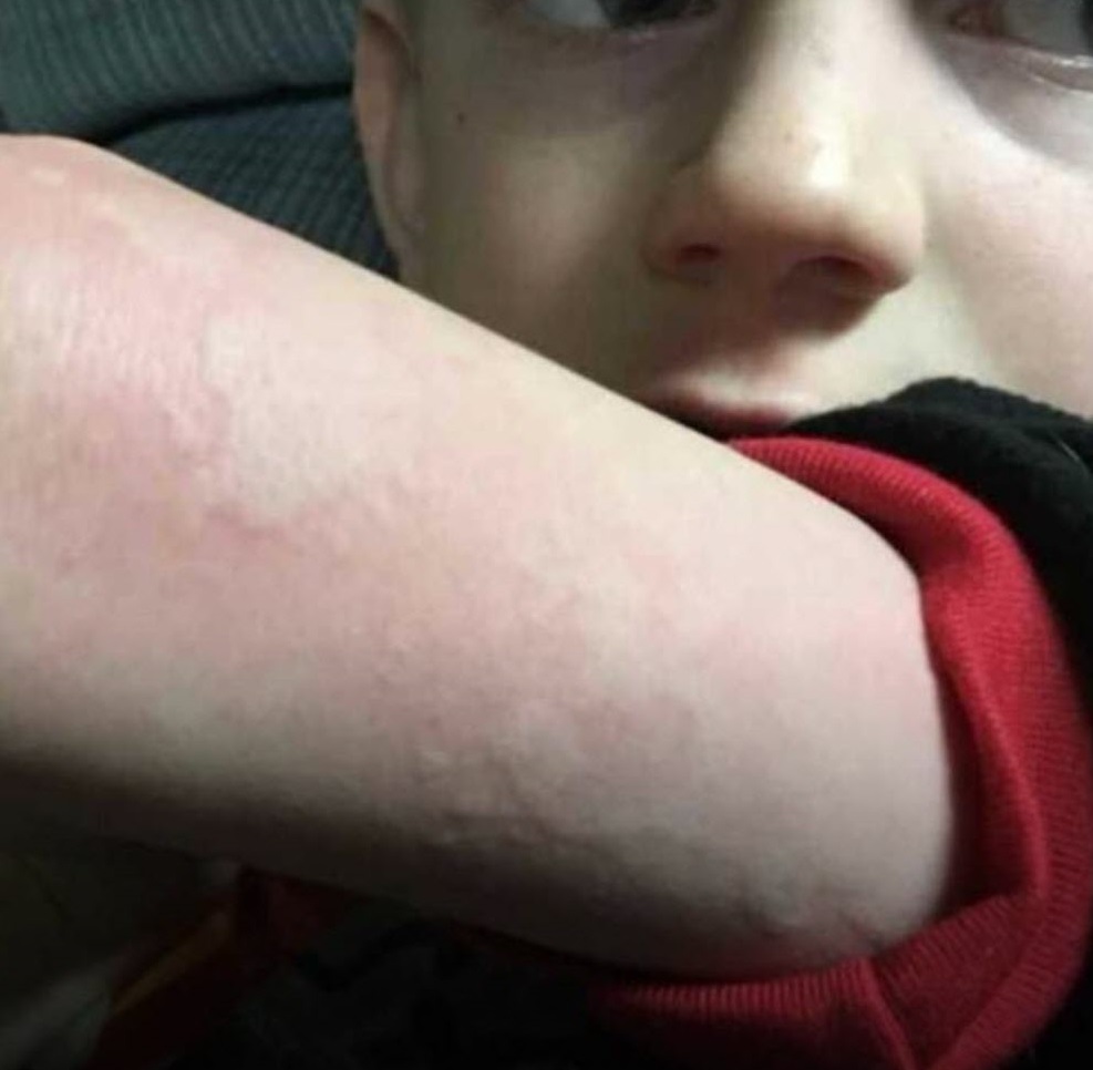 Nurse delivers warning about bizarre, new flu symptom