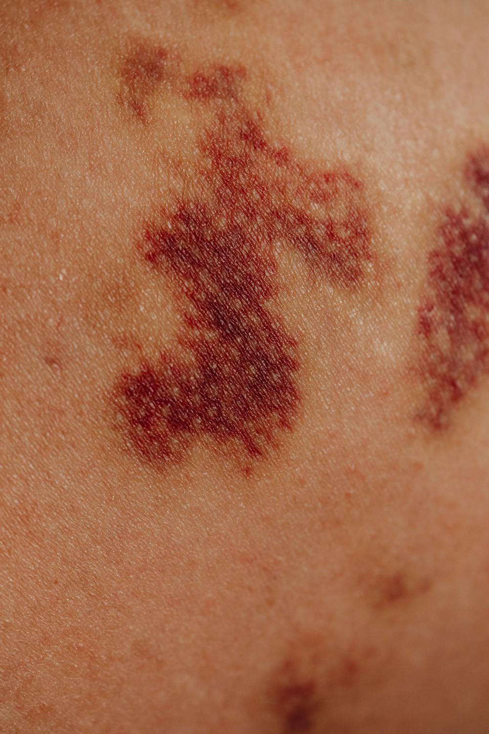 5 warning signs of c4ncer developing in the body