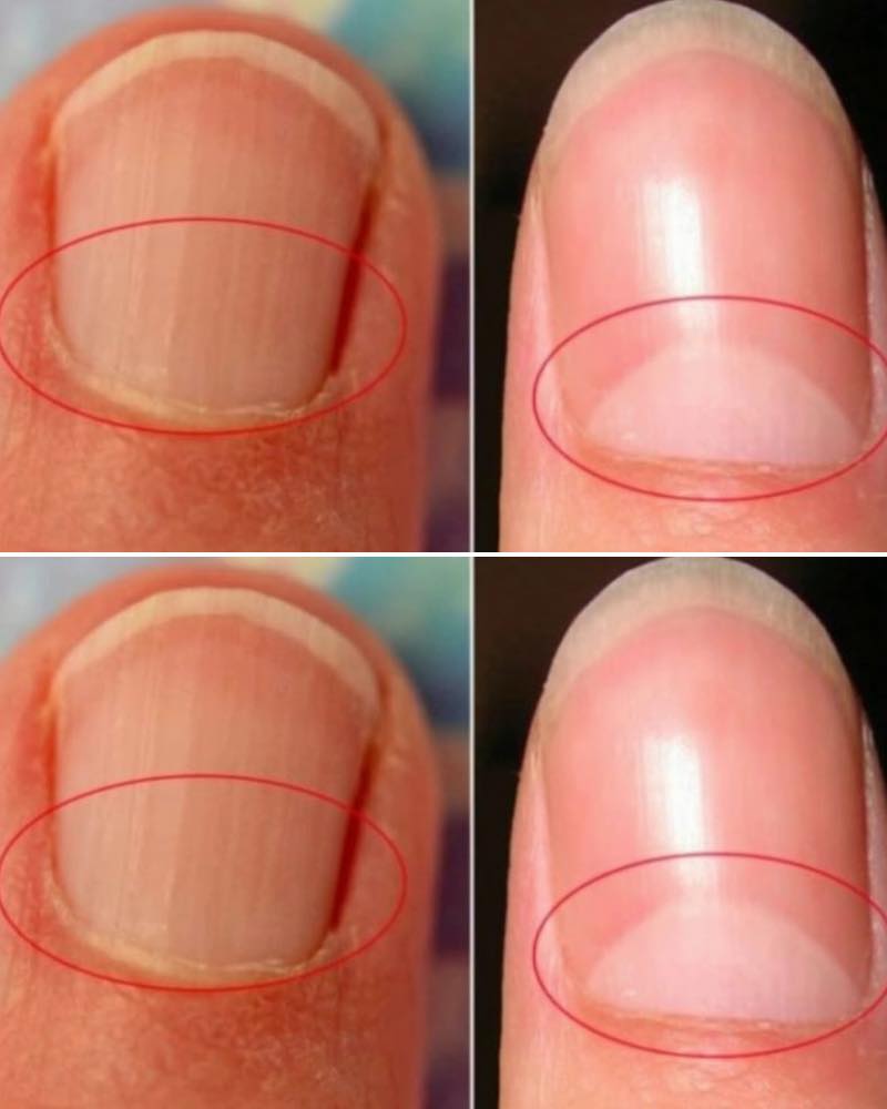 What does the half moon at the base of the nails mean?