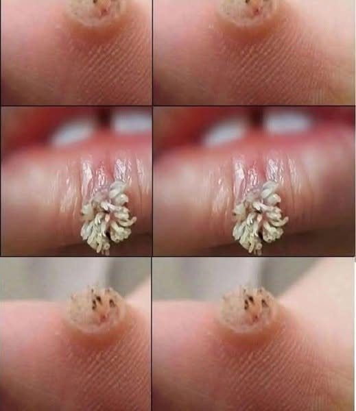 To BE VERY CAREFUL. If you get this, you are infected with …