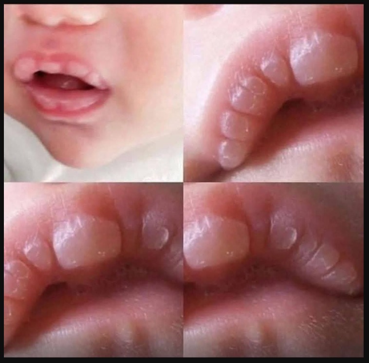 If your baby has these marks it means… See more