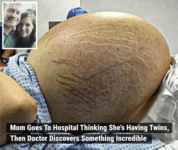 Mom Goes To Hospital Thinking She’s Having Twins, Then Doctor Discovers Something Incredible