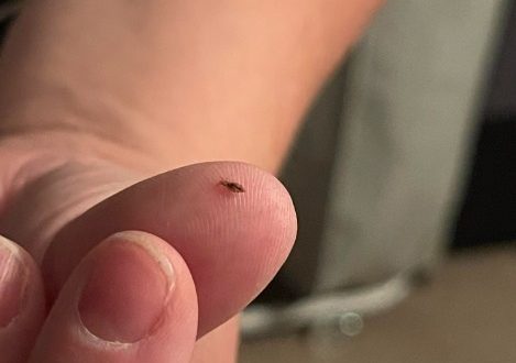 How to keep head lice away from children..check the comment