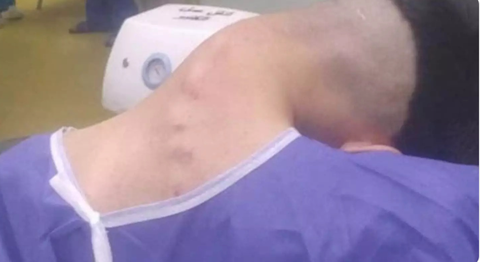 Young man hospitalized because he dropped his ca…See more