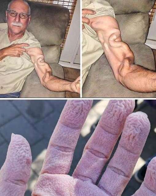 A man goes to stretch and ends up feeling a sharp pain in his arm, it was a ca…