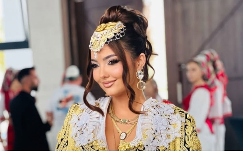 Rita shfaqet ‘ho,t’ në paraqitjen e fundit në Instagram