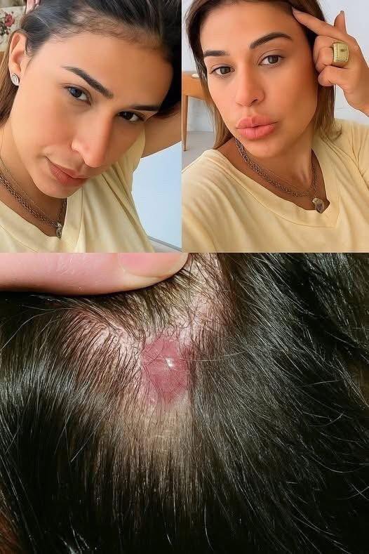 She is taken to the hospital and the diagnosis is revealed. She has… See more