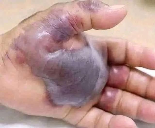 ATTENTION to these first signs of…