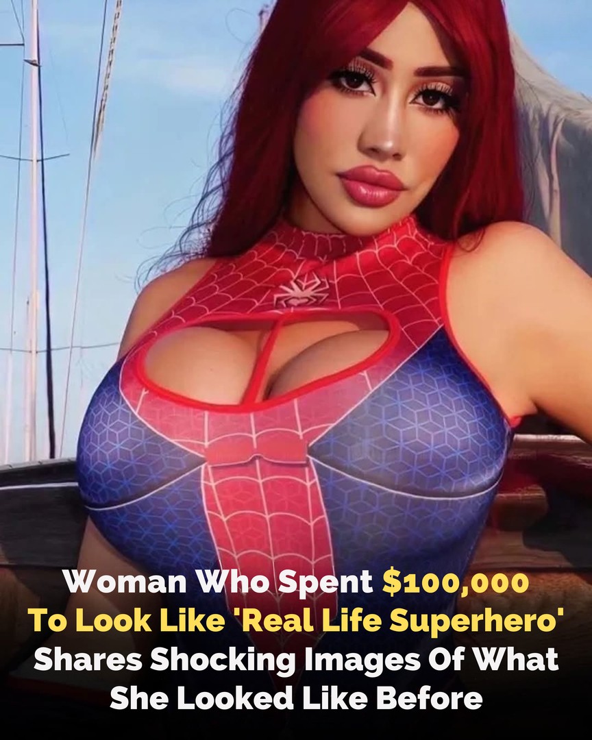 Leslie Luxx Spent $100,000 in a Shocking Transformation to Look Like a ‘Real-Life Superhero’
