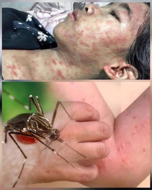 ALERT: New Disease Outbreak in China — Over 7,000 Cases Reported, Symptoms and Risks Revealed..
