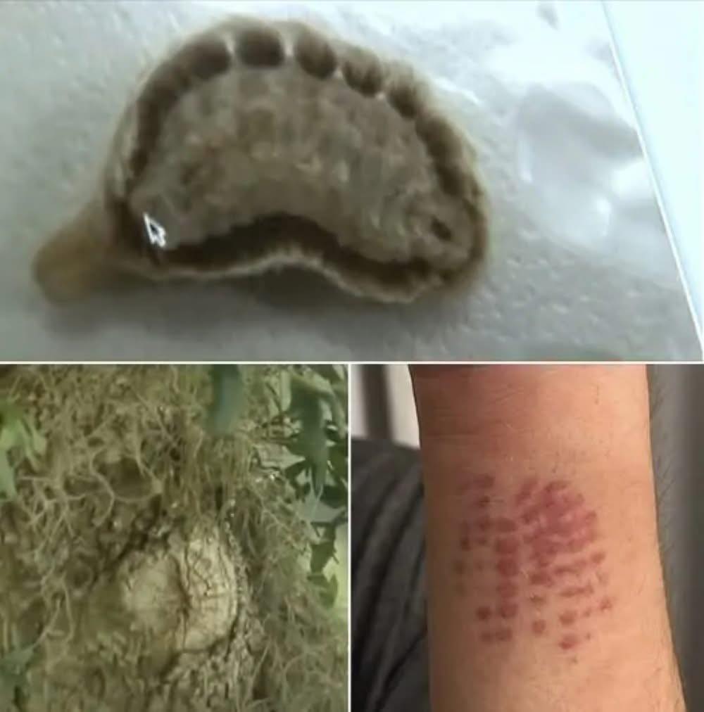 If You Spot This Insect In Your Yard, You Had Better Know What It Is