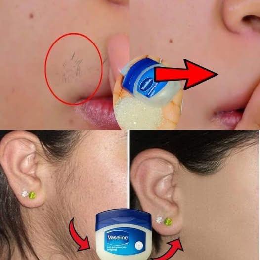 Vaseline for Facial Hair Removal