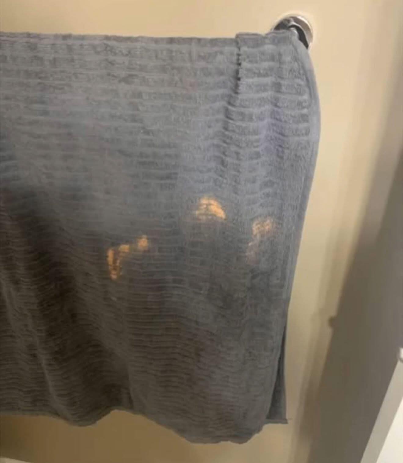 The Real Reason Orange Towel Marks Keep Coming Back