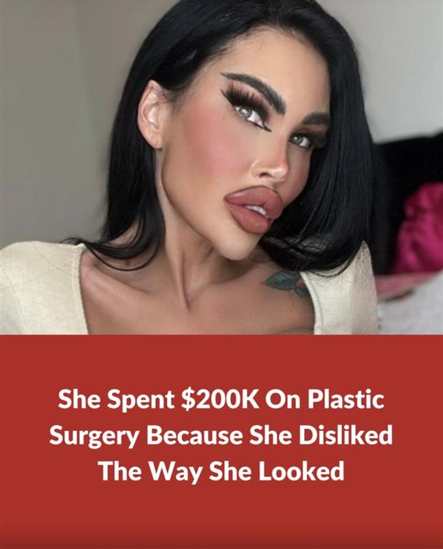 Plastic surgery addict spends $200K on plastic surgery