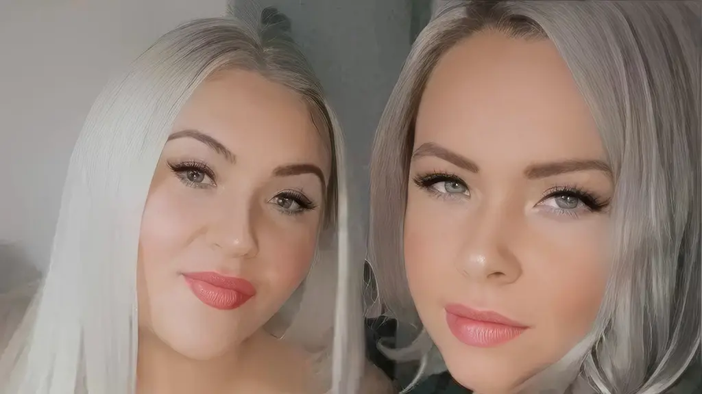 Si një operacion estetik i m0ri jetën një nënë të re