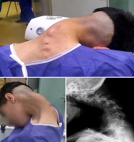 Young man hospitalized because he dropped his ca…See more