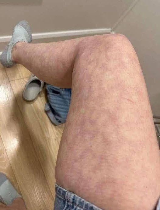 These are the consequences of sleeping with a