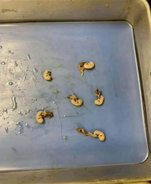 Beware the “Seeds” in Your Snack: Hidden Dangers May Be Closer Than You Think