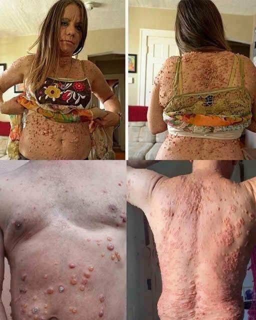 Understanding Skin Bumps and Irritation in Sensitive Areas: Common Causes and When to Seek Care