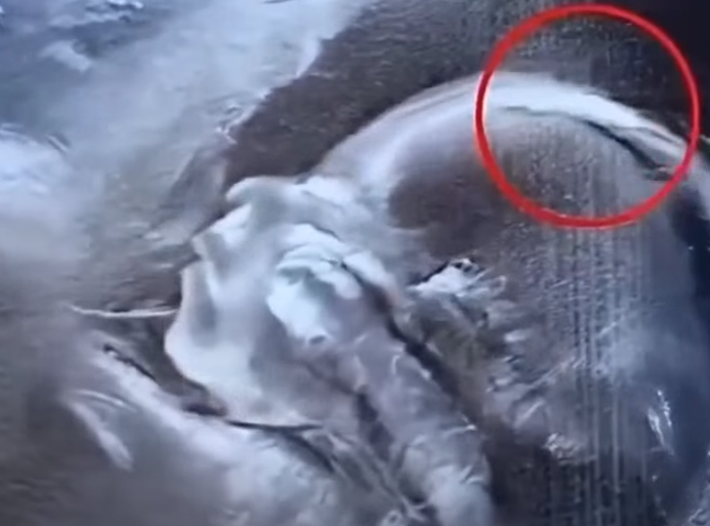 Doctors Couldn’t Believe What Was Inside This Swelling…