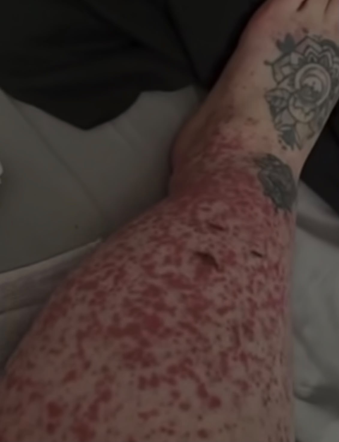 These are the consequences of sleeping withโฆ