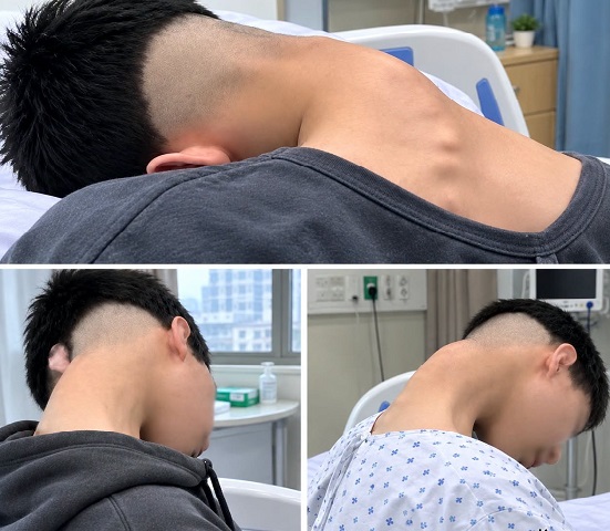 Young Man in Hospital After His Head Suddenly Dropped